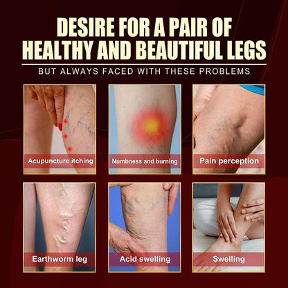 VEIN HEALING VARICOSE VEINS TREATMENT SPRAY - Buy 1 Get 1 FREE