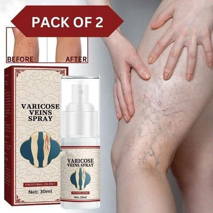 VEIN HEALING VARICOSE VEINS TREATMENT SPRAY - Buy 1 Get 1 FREE